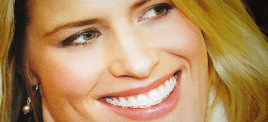 Elsa Skarpari - Orthodontist - Larnaca Happy Smiles